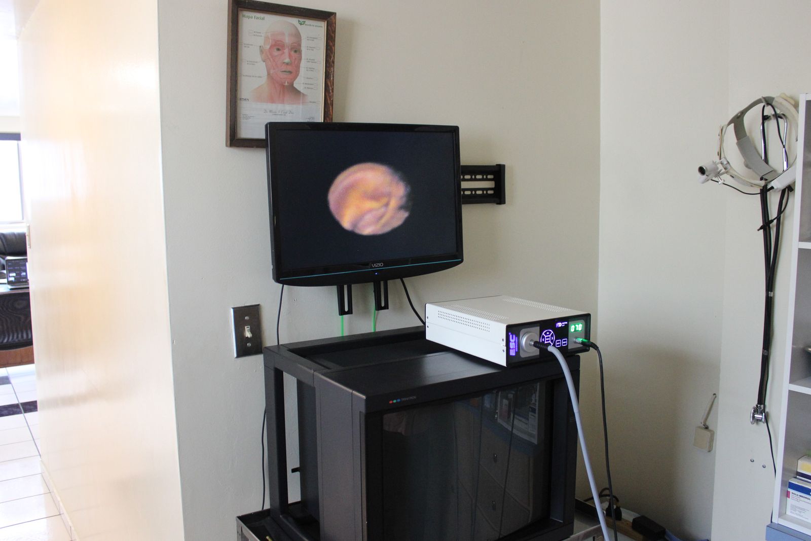 Torre de endoscopia del consultorio con monitor, fuente de luz y lámpara frontal